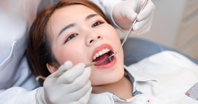 Tips Menghilangkan Karang Gigi Secara Ampuh